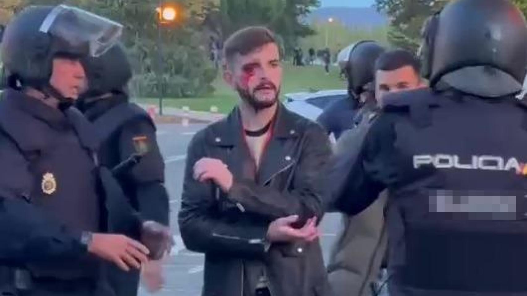 Brutal agresión de 'abertzales' encapuchados al periodista de El Español que informaba de su protesta ilegal en Pamplona