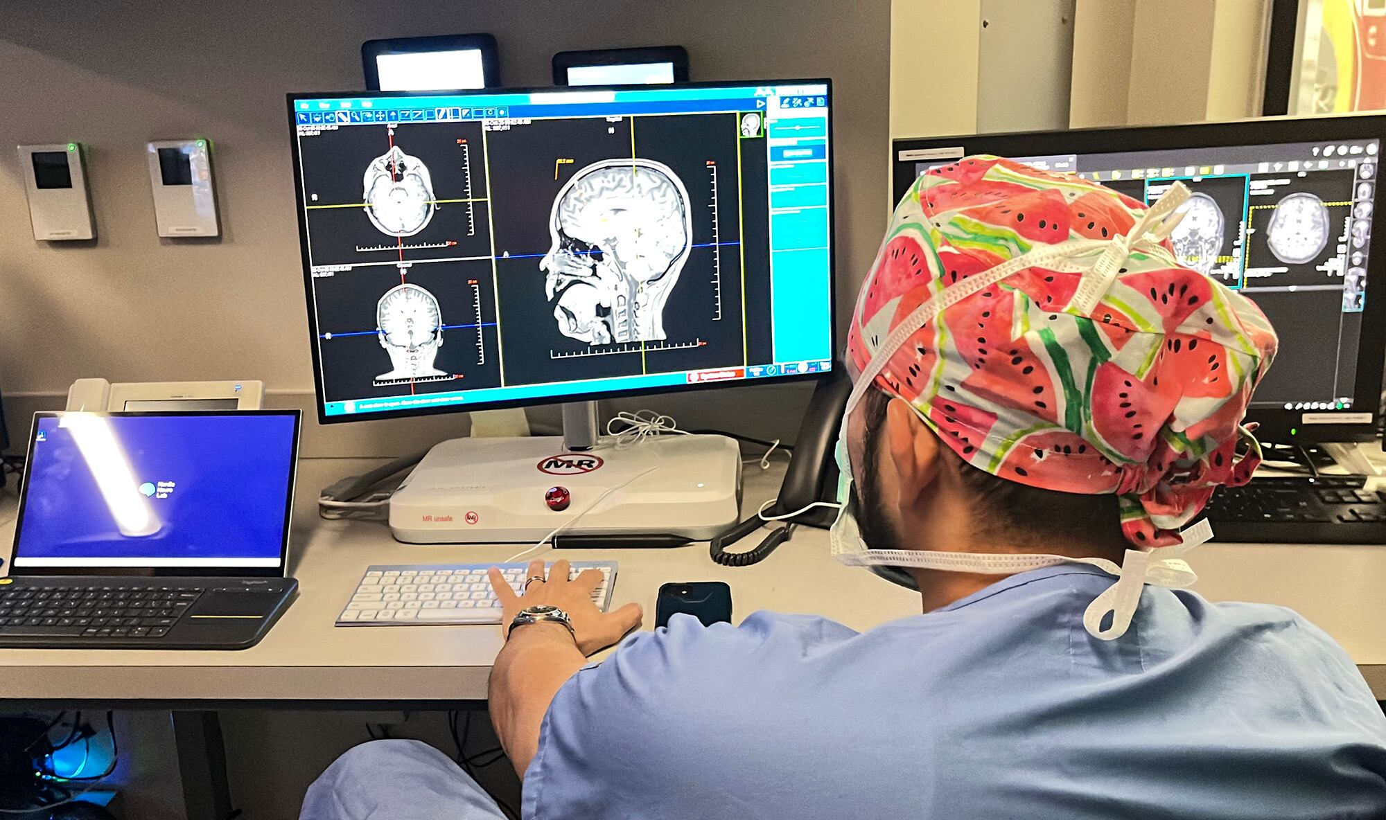 Los neurólogos alertan ante una polémica cirugía para tratar la migraña: “Falta evidencia científica”