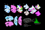 NextBrain, un atlas cerebral que desvela subregiones clave para la detección precoz de enfermedades neurodegenerativas