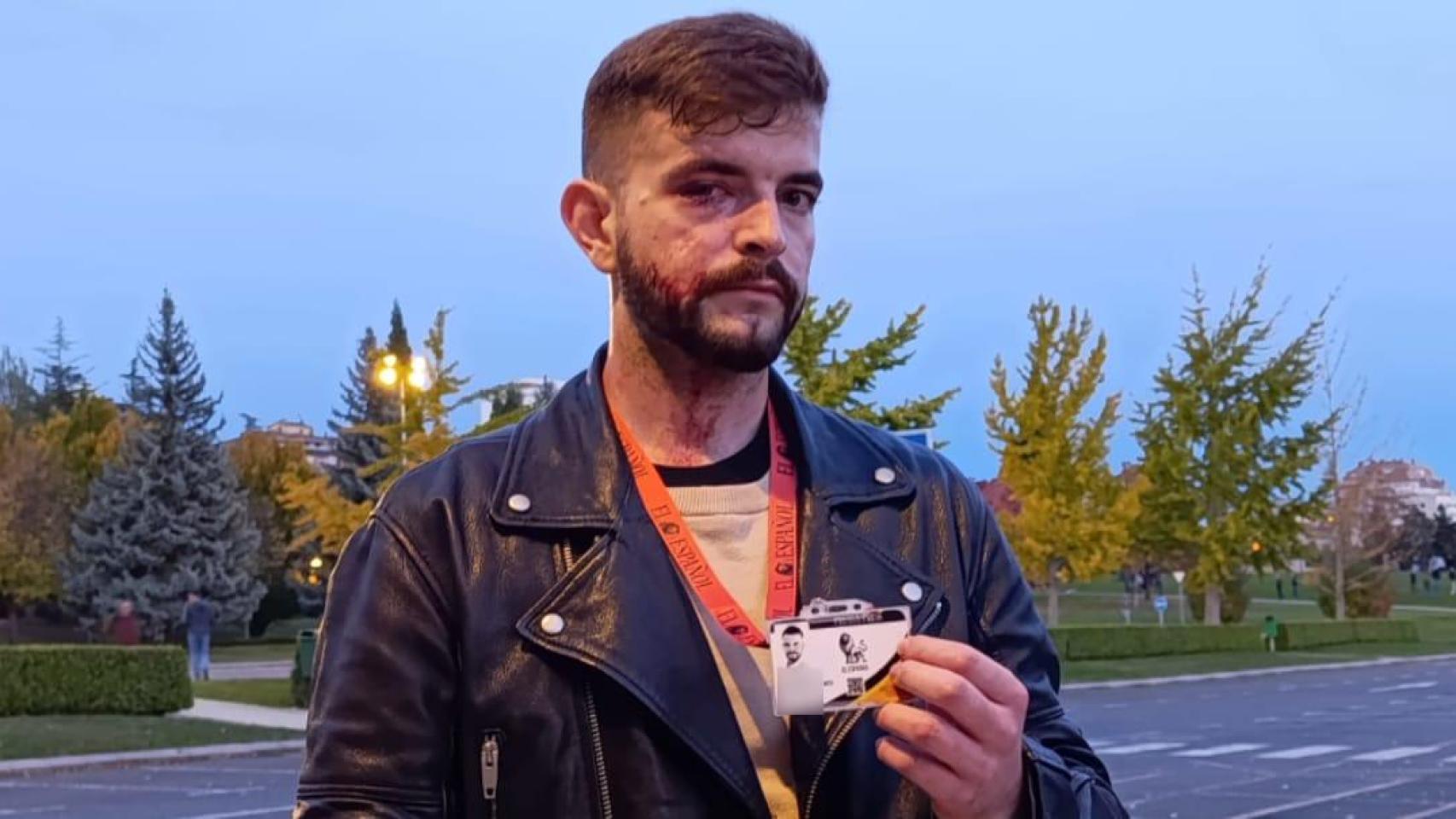 "Recibí pedradas, patadas... No sé cuántos golpes me dieron: el infierno que viví informando de la 'kale borroka' en Pamplona"