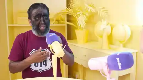 Imagen 1 de Chuy, 'el hombre lobo' mexicano: "Cuando tenía 12 años los periódicos nos sacaron fotos sin permiso"