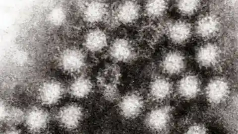 Imagen 1 de Descubren cómo actúa la variante del virus que ha disparado los casos de gastroenteritis en todo el mundo