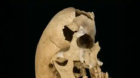 Imagen 1 de El caballero de la orden de Calatrava que superó una severa deformidad de nacimiento en el cráneo y murió en plena batalla hace 600 años