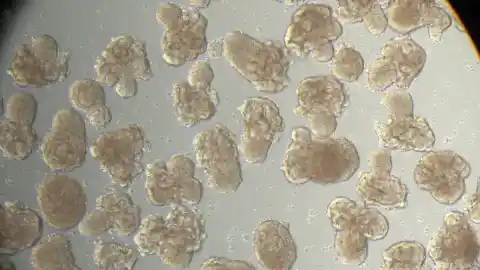 Imagen 1 de Los organoides de riñón producidos en serie abren la vía a mejorar los trasplantes