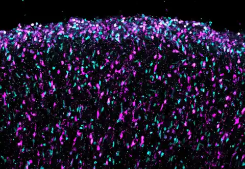 Imagen 1 de El primer mapa del cerebro en formación permite vislumbrar el origen de los trastornos de la mente