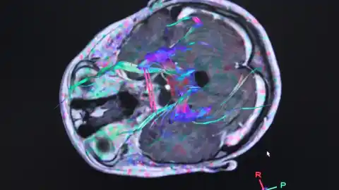 Imagen 1 de Hallan un patrón en enfermedades de cerebro e intestino que mejoraría la detección del Párkinson