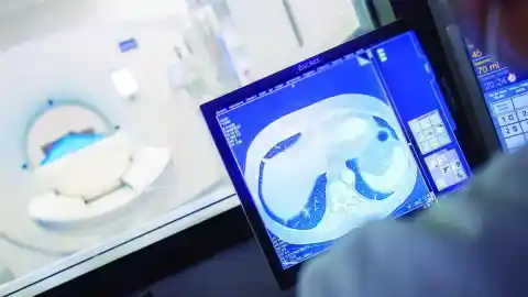 Imagen 1 de Cómo tratar enfermedades pulmonares a bajo cero sin necesidad de ir a la Antártida