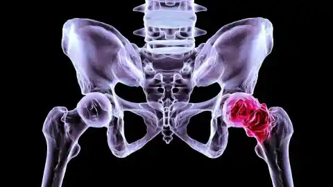 Imagen 1 de Descubren por qué se destruye el cartílago en la artrosis y cómo regenerarlo