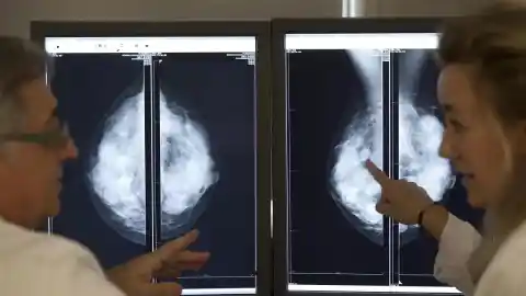 Imagen 1 de Las mamografías no provocan cáncer, como afirman mensajes virales: salvan vidas