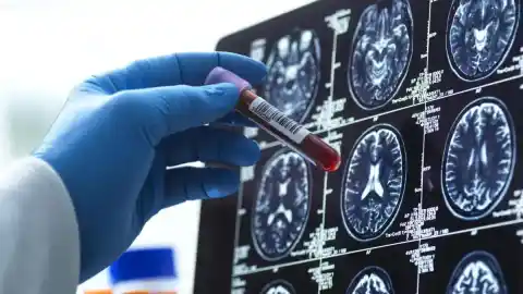 Imagen 1 de El 10% de los mayores de 70 años tiene alzheimer pero aún no tiene síntomas