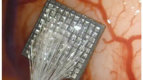 Imagen 1 de Implantes que se comunican con el cerebro: el futuro de la neurotecnología ya está en marcha