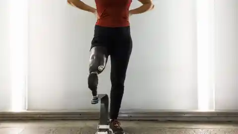 Imagen 1 de J.V.V., amputada hace tres años: ​"Tuve que aprender a caminar de nuevo, es muy distinto cpn una prótesis"