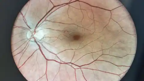 Imagen 1 de Descubren un fármaco que protege la retina frente a una de las principales causas de ceguera: "Podría trasladarse a pacientes en algunos años"