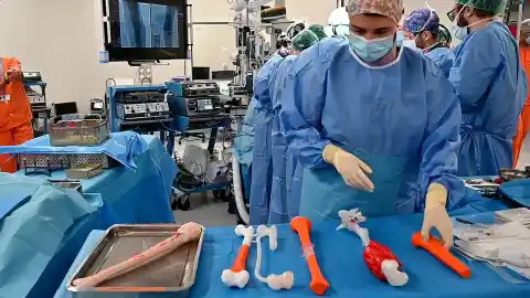 Imagen 1 de El Gregorio Marañón evita amputar la pierna de un niño con cáncer al reconstruir su fémur con una tibia de un adulto