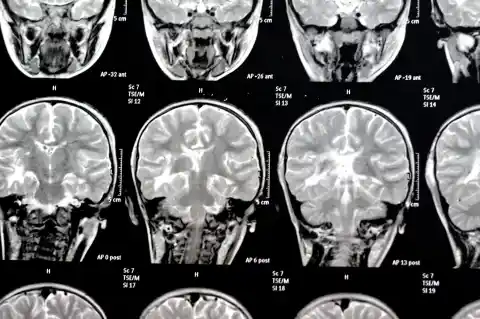 Imagen 1 de De Borges a Jennifer Aniston: la ciencia empieza a iluminar los misterios de la memoria