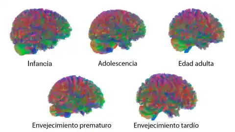 Imagen 1 de Las cinco ‘edades’ del cerebro humano: hay cambios cruciales alrededor de los 9, los 32, los 66 y los 83 años